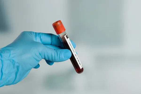 Lab tests
